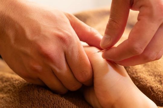 池袋の鍼灸院の施術風景